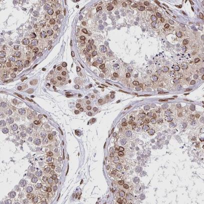 Emerin Antibody