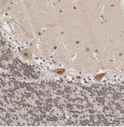 KAT3B/p300 Antibody