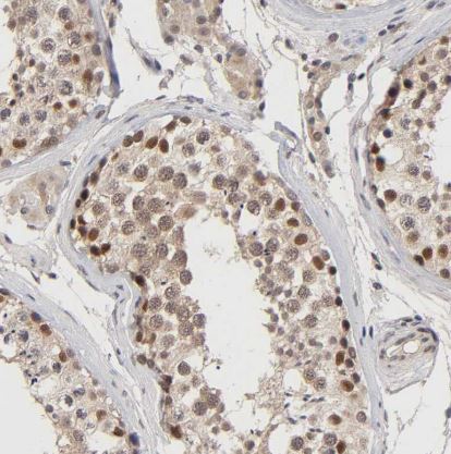 KAT3B/p300 Antibody