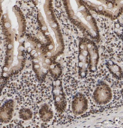 KAT3B/p300 Antibody