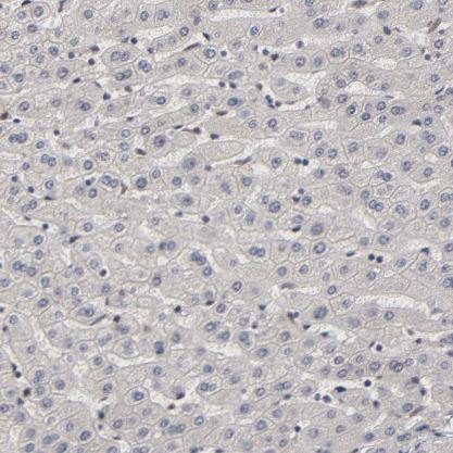 KAT3B/p300 Antibody
