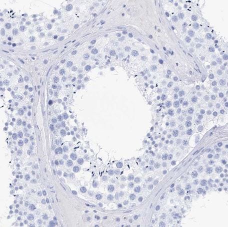 Lactalbumin Alpha Antibody Lactalbumin Alpha Antibody