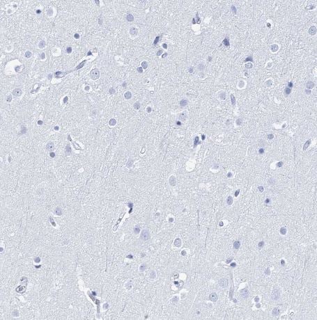 Lactalbumin Alpha Antibody Lactalbumin Alpha Antibody