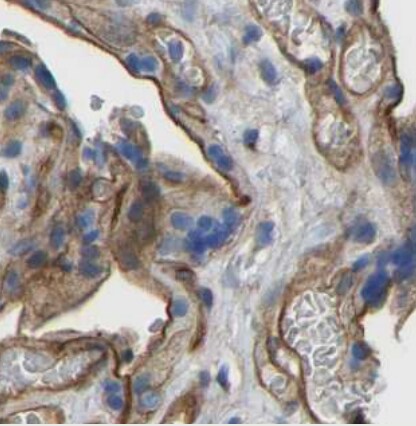 Myosin 1C Antibody