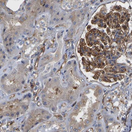 Myosin 1C Antibody