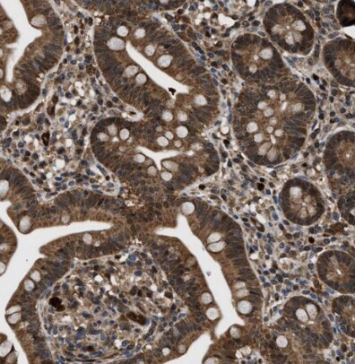 Inorganic Pyrophosphatase/PPA1 Antibody