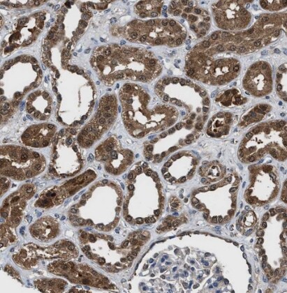 Inorganic Pyrophosphatase/PPA1 Antibody