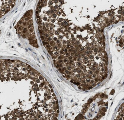 Inorganic Pyrophosphatase/PPA1 Antibody
