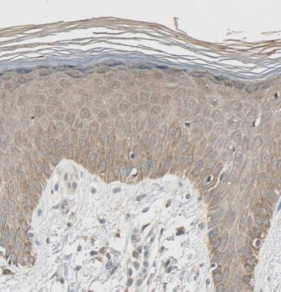 TAK1 Antibody - BSA Free