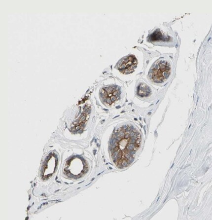 TAK1 Antibody - BSA Free