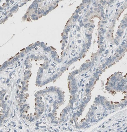 TAK1 Antibody - BSA Free