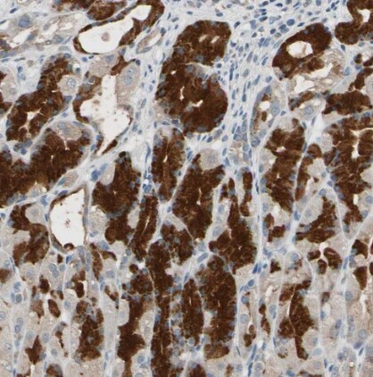 TAK1 Antibody - BSA Free