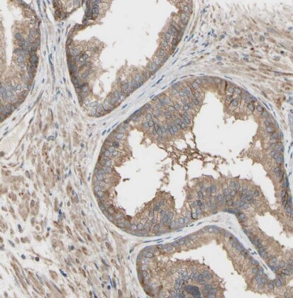 IRAG Antibody - BSA Free