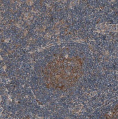 IRAG Antibody - BSA Free