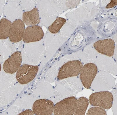 URB/CCD80 Antibody