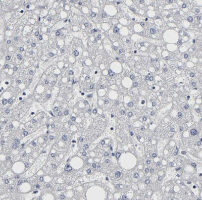 URB/CCD80 Antibody