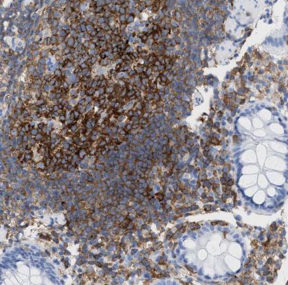 Plastin L Antibody