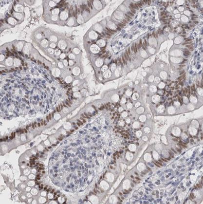 Th-POK Antibody