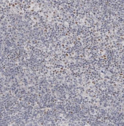 Th-POK Antibody