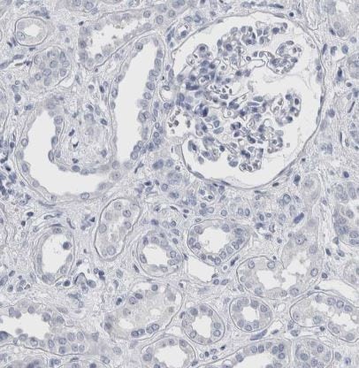 Cadherin-17 Antibody