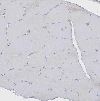 ITM2B Antibody