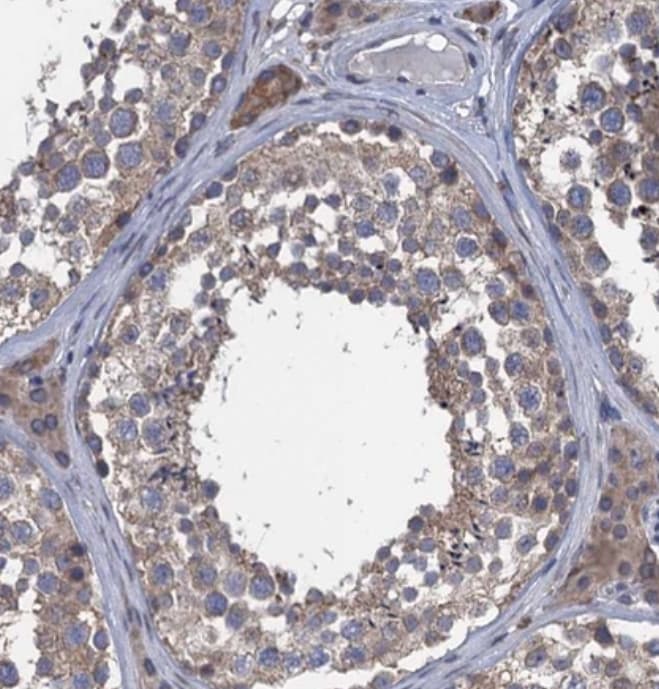 CTU2 Antibody - BSA Free