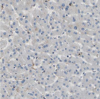 SUSD2 Antibody