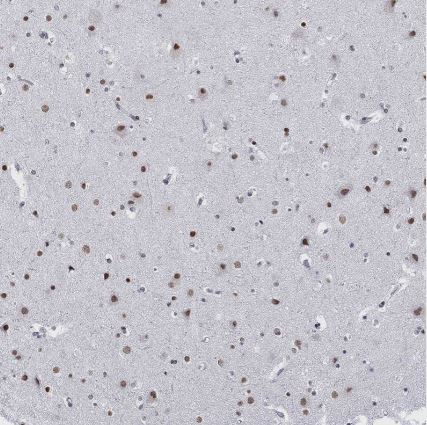 NPAS3 Antibody