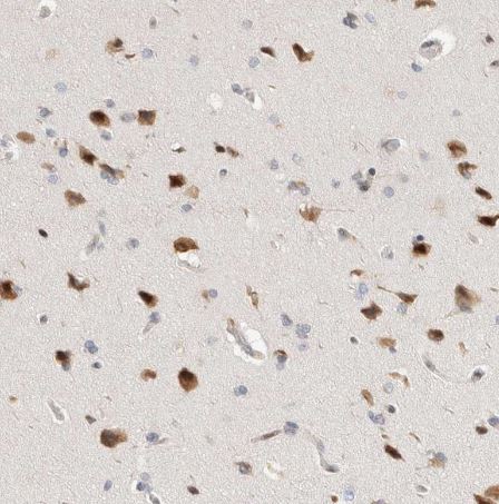 TCF4 Antibody