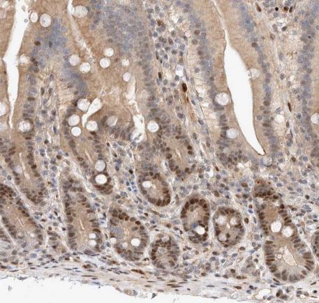 TCF4 Antibody