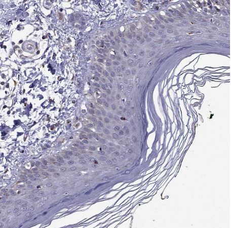 B4GALT7 Antibody