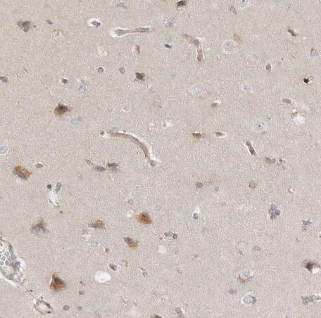 TRAPPC3 Antibody [NBP1-88664]
