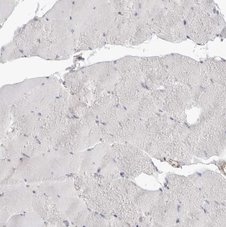 TRAPPC3 Antibody [NBP1-88664]