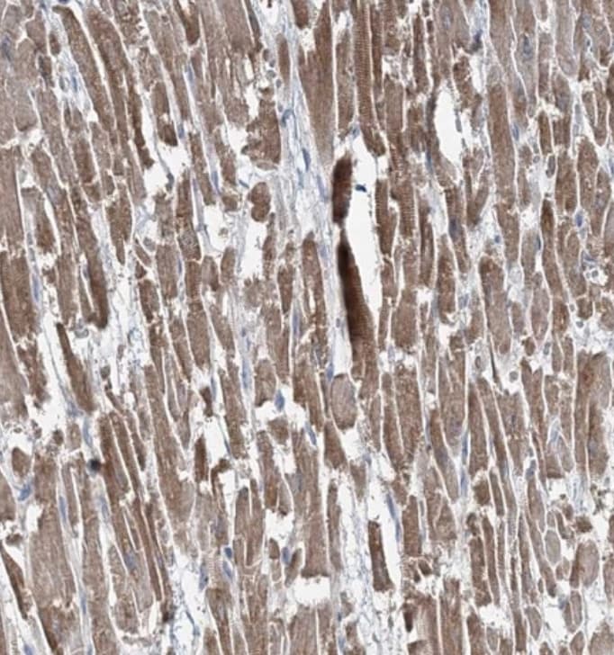 TMLHE Antibody - BSA Free