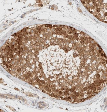 ARFGEF1 Antibody