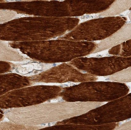 ARFGEF1 Antibody