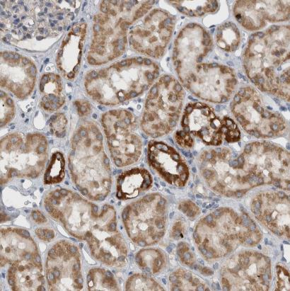 ARMC1 Antibody