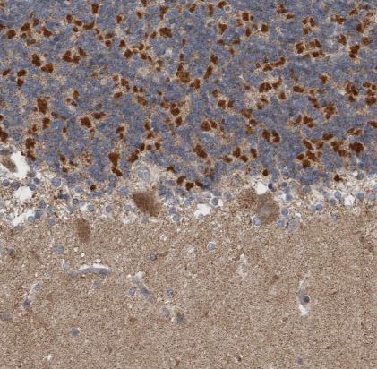 ARMC1 Antibody