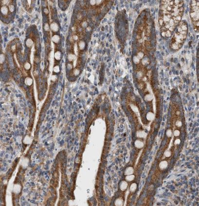 ARMC1 Antibody