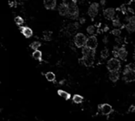 SLC38A2 Antibody