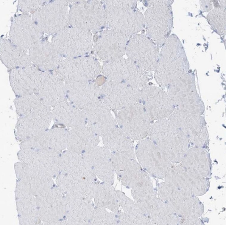 ATP11C Antibody - BSA Free