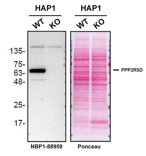 PPP2R5D Antibody