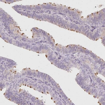 LRRC23 Antibody - BSA Free