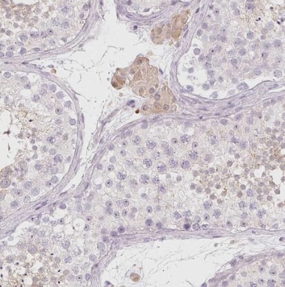 LRRC23 Antibody - BSA Free