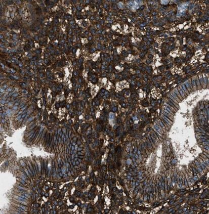 B7-H3/CD276 Antibody