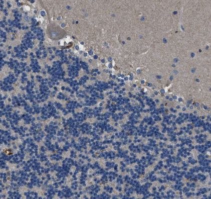 B7-H3/CD276 Antibody