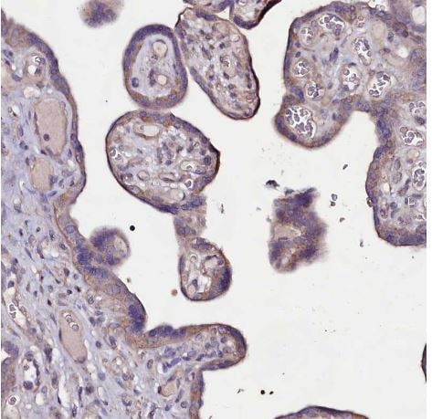 USPL1 Antibody