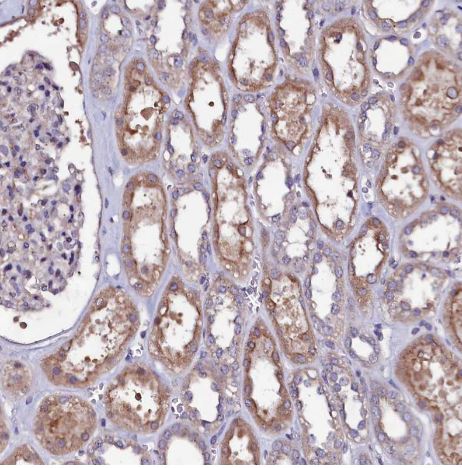 USPL1 Antibody