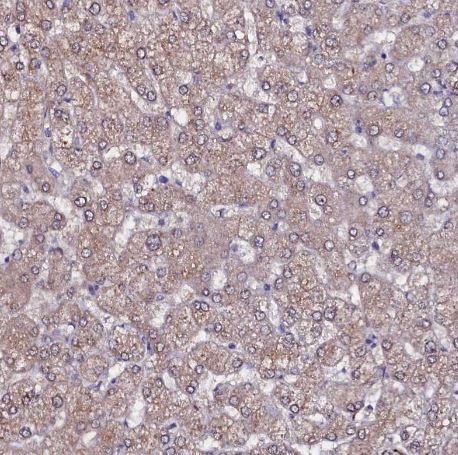 USPL1 Antibody