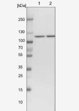 SART1 Antibody